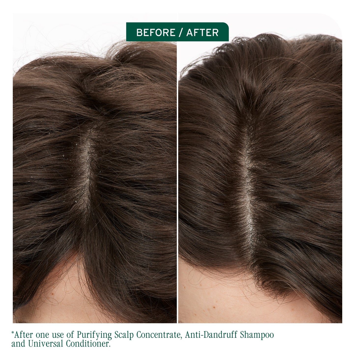 Matrix Biolage ScalpSync Anti-Dandruff Shampoo 400ml NEW