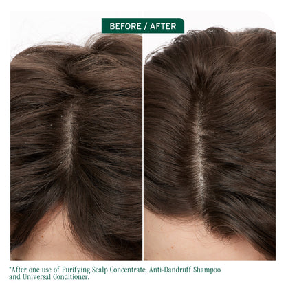 Matrix Biolage ScalpSync Anti-Dandruff Shampoo 400ml NEW