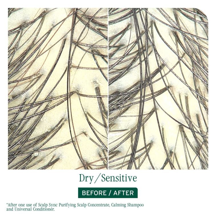 Matrix Biolage ScalpSync Calming Shampoo 1000ml NEW