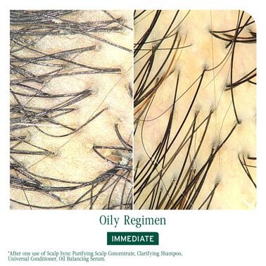 Matrix Biolage ScalpSync Purifying Scalp Concentrate 200ml NEW