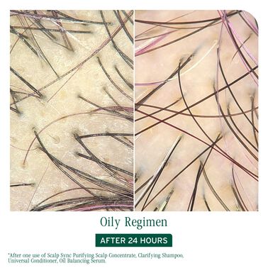 Matrix Biolage ScalpSync Purifying Scalp Concentrate 200ml NEW