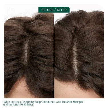 Matrix Biolage ScalpSync Purifying Scalp Concentrate 200ml NEW