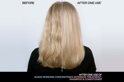 Acidic Bonding Concentrate Intensive Treatment 150ml